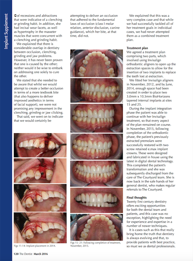 UntitledImplants-Dental-Treatment-Horizons-Macros-White-The-Courtyard-Page-2