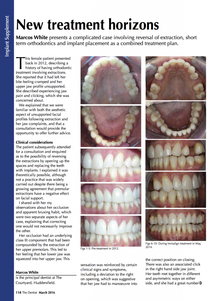 Implants-Dental-Treatment-Horizons-Macros-White-The-Courtyard